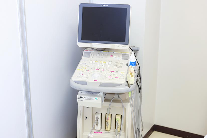 超音波診断装置