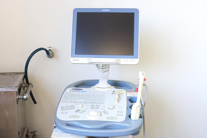 超音波診断装置装置